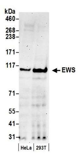 Detection of human EWS by western blot.