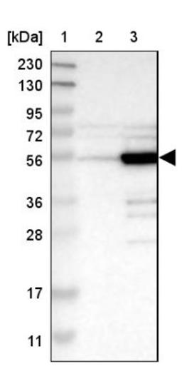 Western Blot: PDLIM7 Antibody [NBP1-84841] - Lane 1: Marker [kDa] 230, 130, 95, 72, 56, 36, 28, 17, 11<br/>Lane 2: Human cell line RT-4<br/>Lane 3: Human cell line U-251MG sp