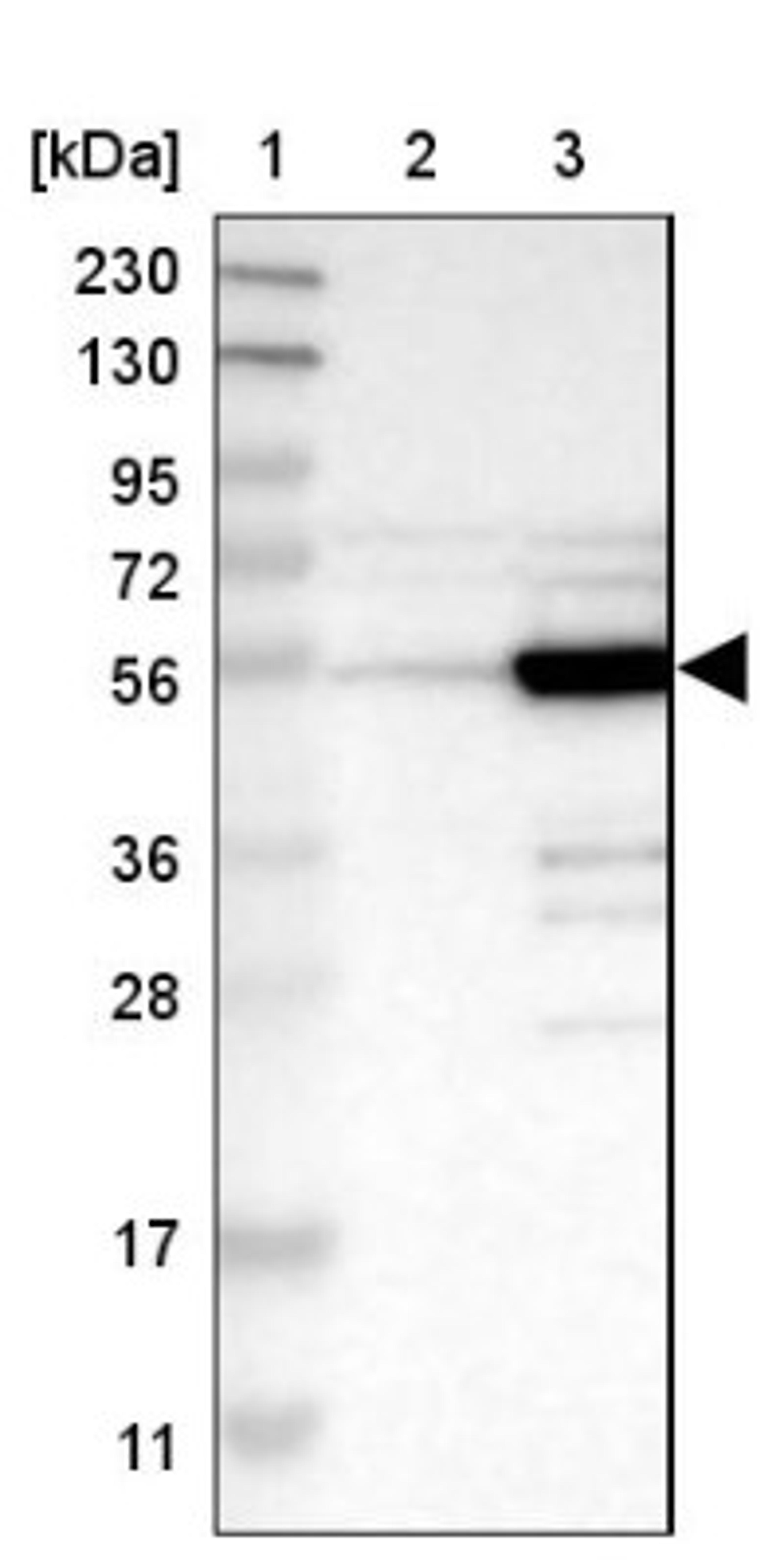 Western Blot: PDLIM7 Antibody [NBP1-84841] - Lane 1: Marker [kDa] 230, 130, 95, 72, 56, 36, 28, 17, 11<br/>Lane 2: Human cell line RT-4<br/>Lane 3: Human cell line U-251MG sp