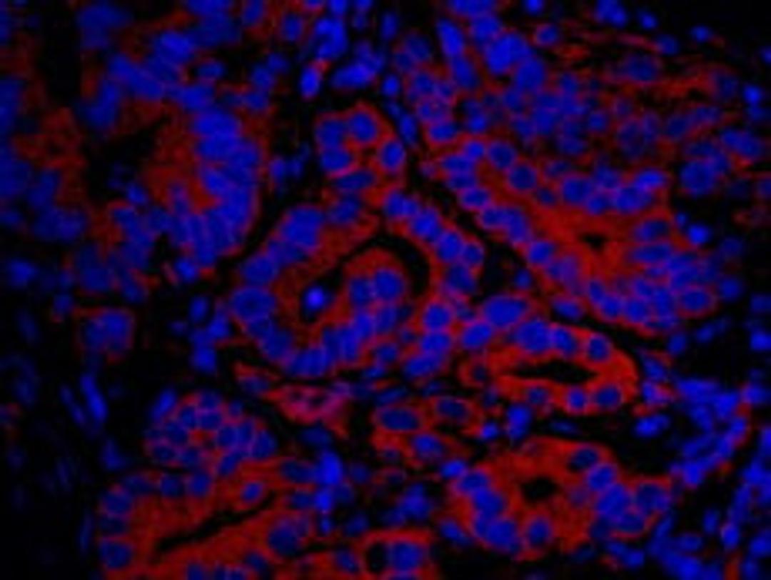 Detection of human IP3R3 by immunohistochemistry.