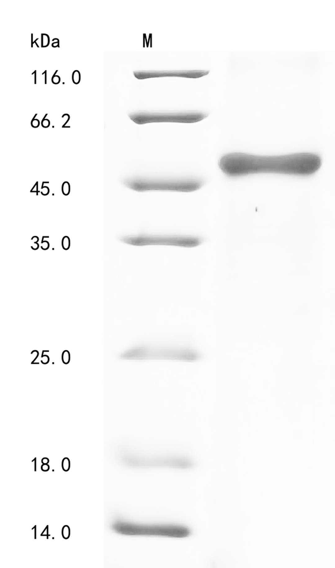 (Tris-Glycine gel) Discontinuous SDS-PAGE (reduced) with 5% enrichment gel and 15% separation gel.