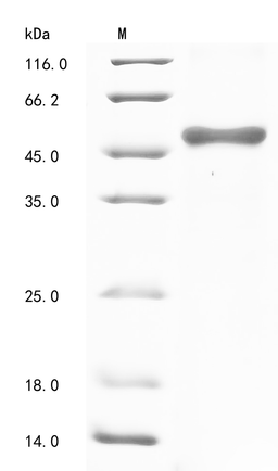 (Tris-Glycine gel) Discontinuous SDS-PAGE (reduced) with 5% enrichment gel and 15% separation gel.