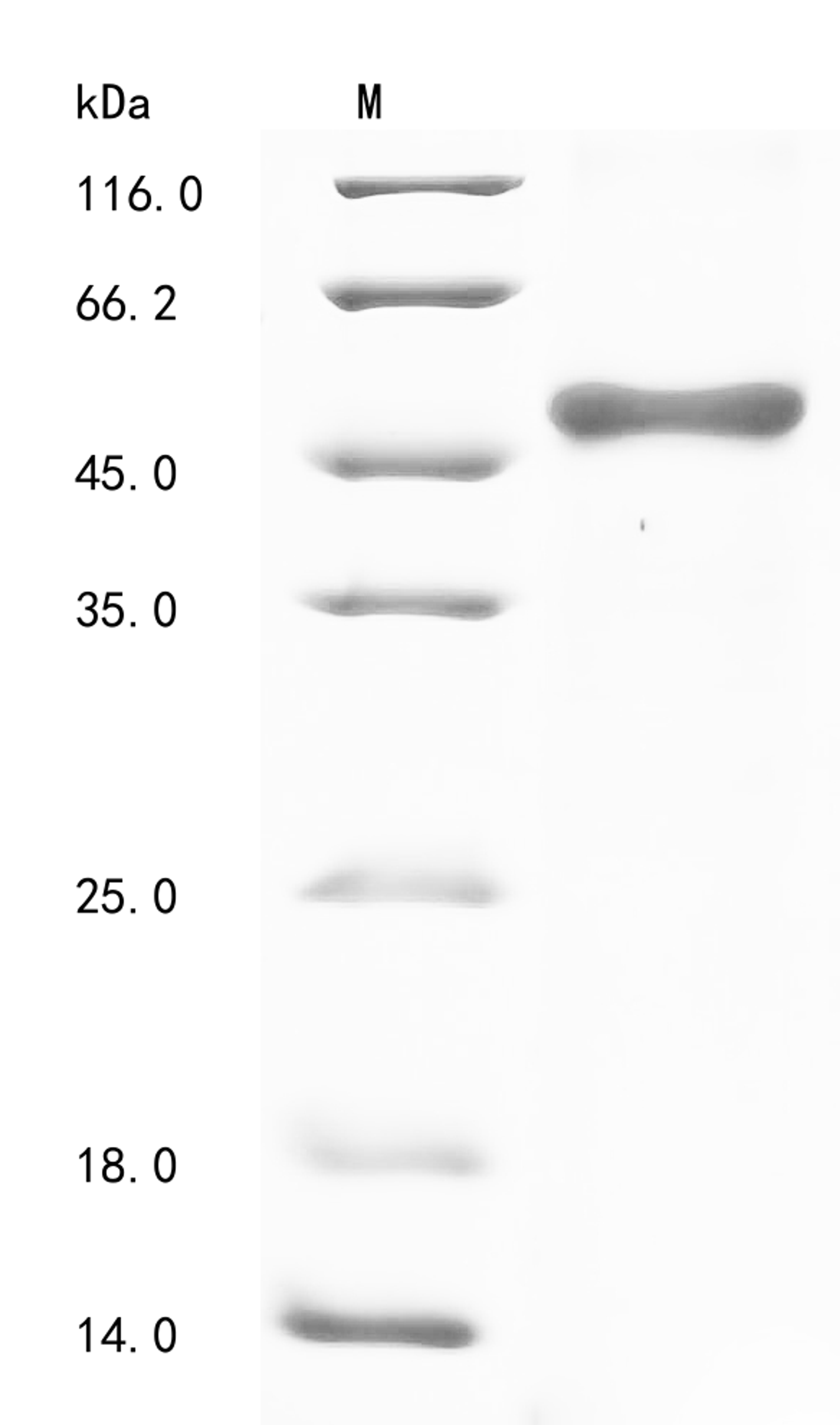 (Tris-Glycine gel) Discontinuous SDS-PAGE (reduced) with 5% enrichment gel and 15% separation gel.