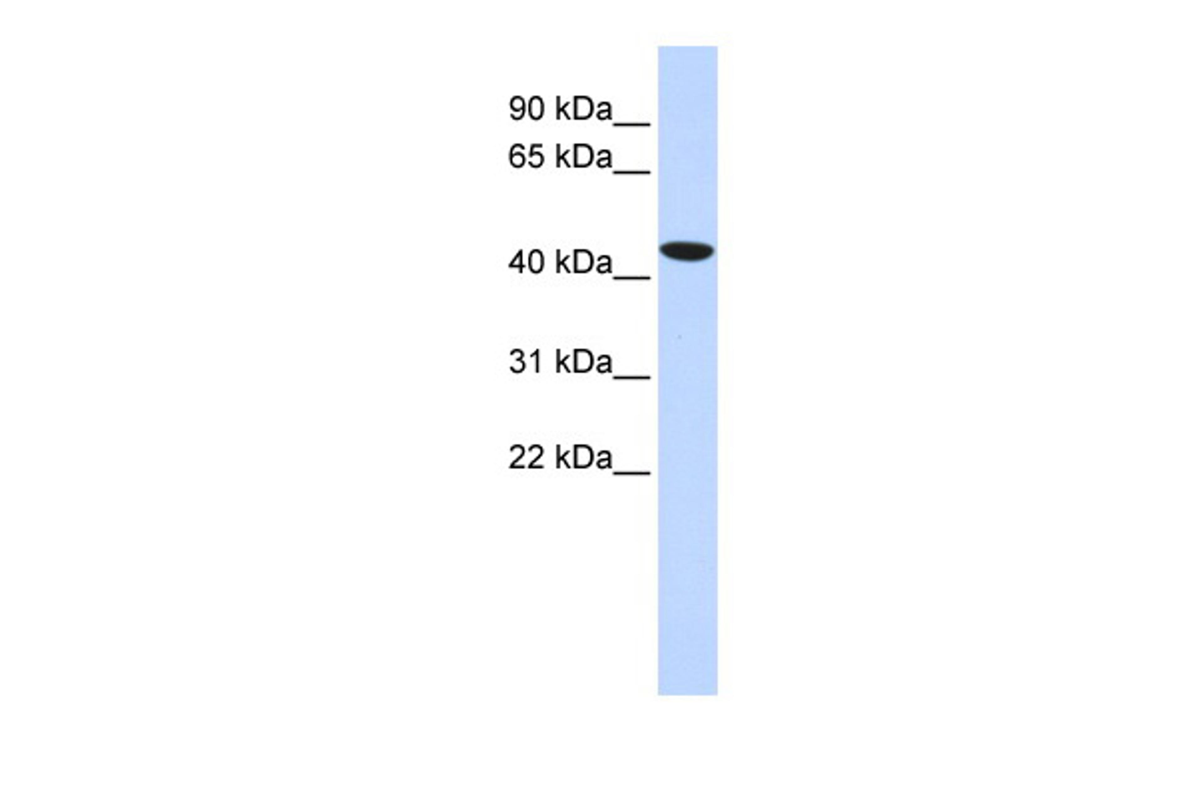 Antibody used in WB on Human Lung at 0.2-1 ug/ml.