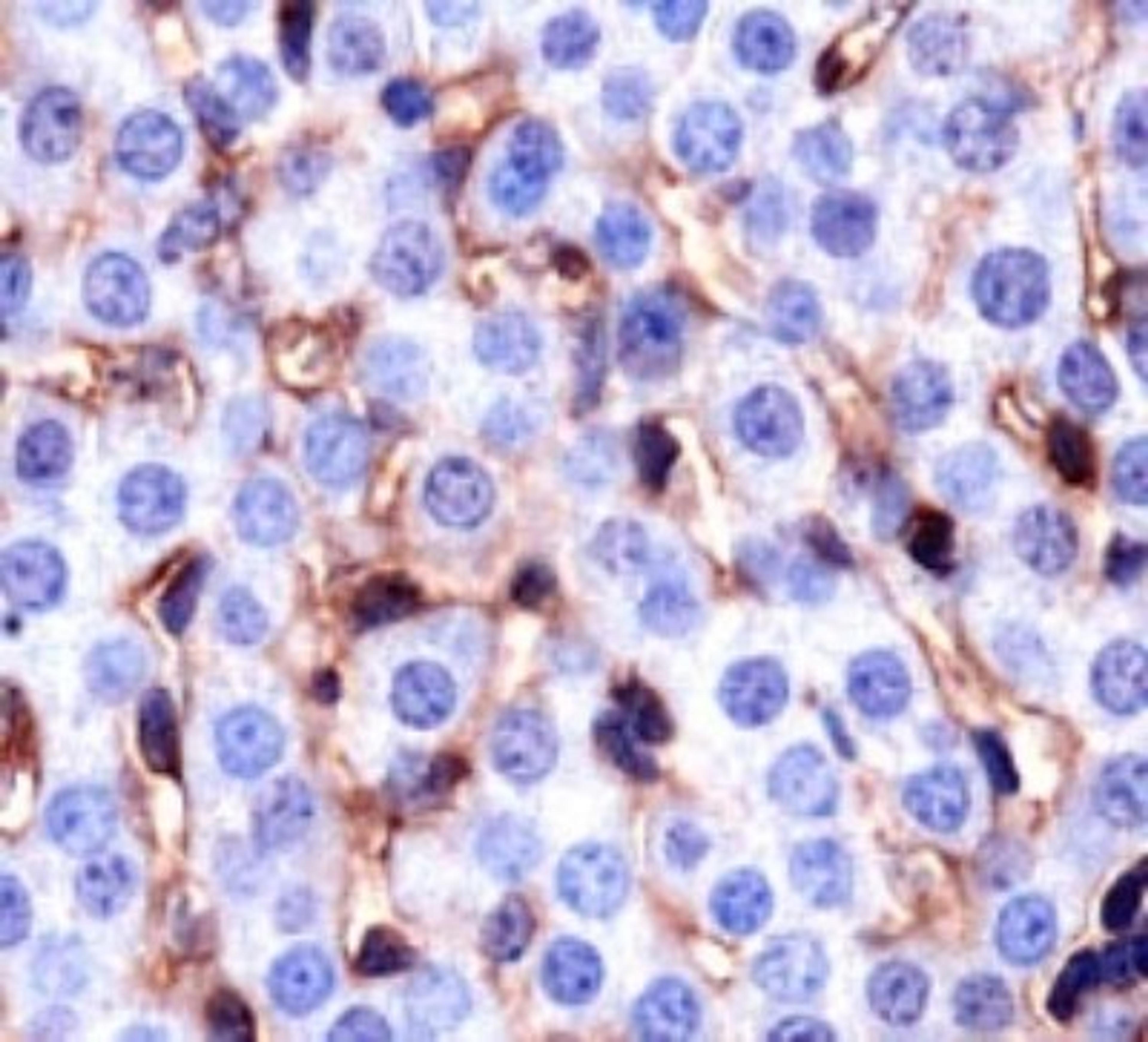 Immunohistochemistry: CD36 Antibody (D-2712) [NB110-59724] - Staining of CD36 in mouse liver.