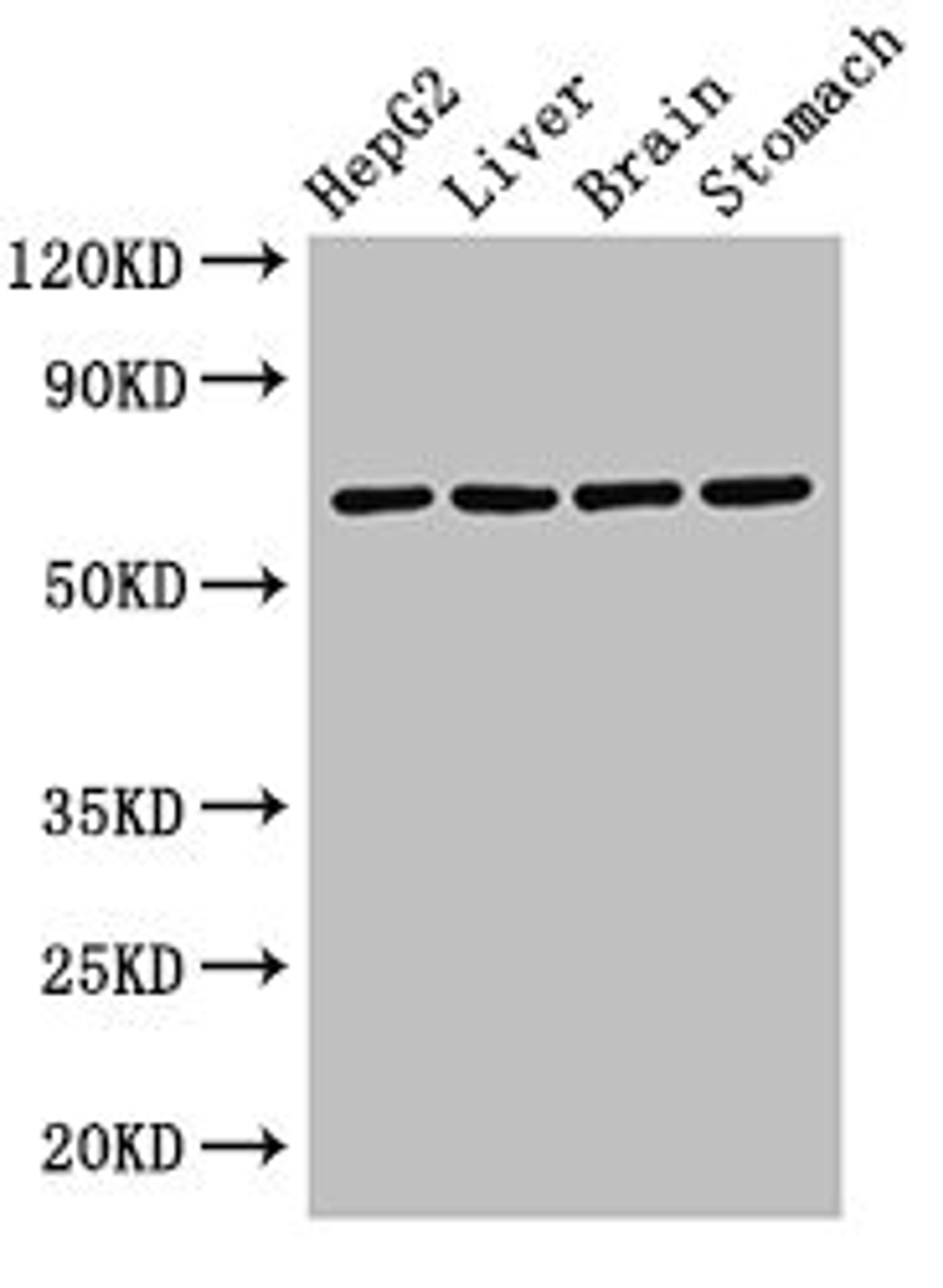 Western Blot. Positive WB detected in: HepG2 whole cell lysate, Rat liver tissue, Rat brain tissue, Rat stomach tissue. All lanes: RCBTB2 antibody at 3.2µg/ml. Secondary. Goat polyclonal to rabbit IgG at 1/50000 dilution. Predicted band size: 61, 58 kDa. Observed band size: 61 kDa