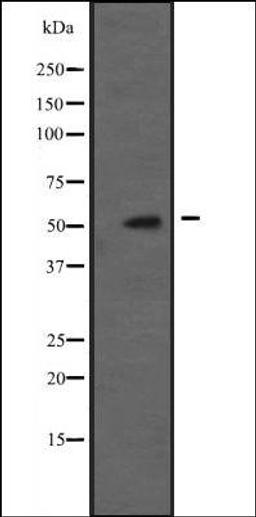 Western blot analysis of A431 whole cell lysate using PCTK1 antibody