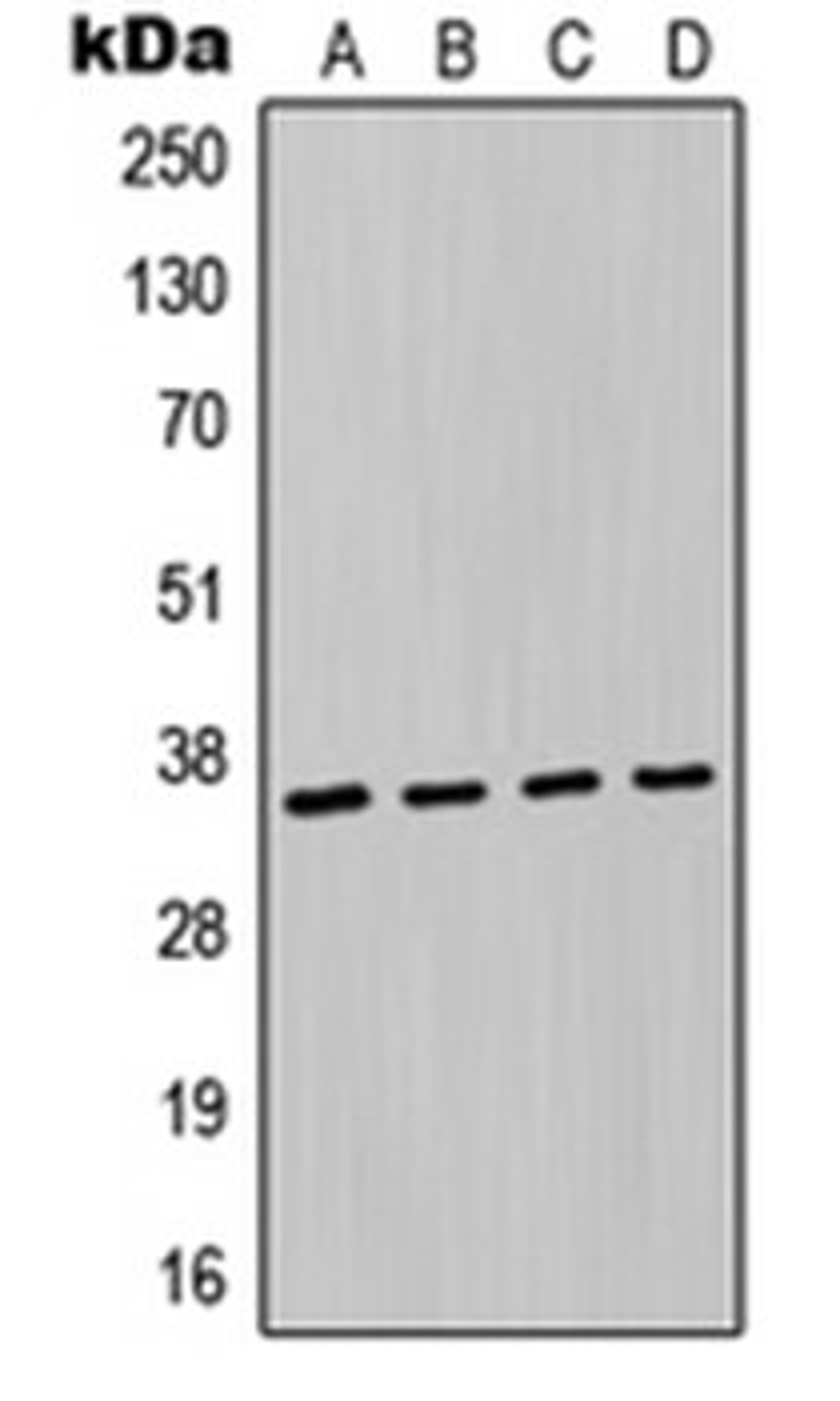 Western blot analysis of A549 (Lane 1), MCF7 (Lane 2), NIH3T3 (Lane 3), H9C2 (Lane 4) whole cell lysates using MAGEA6 antibody