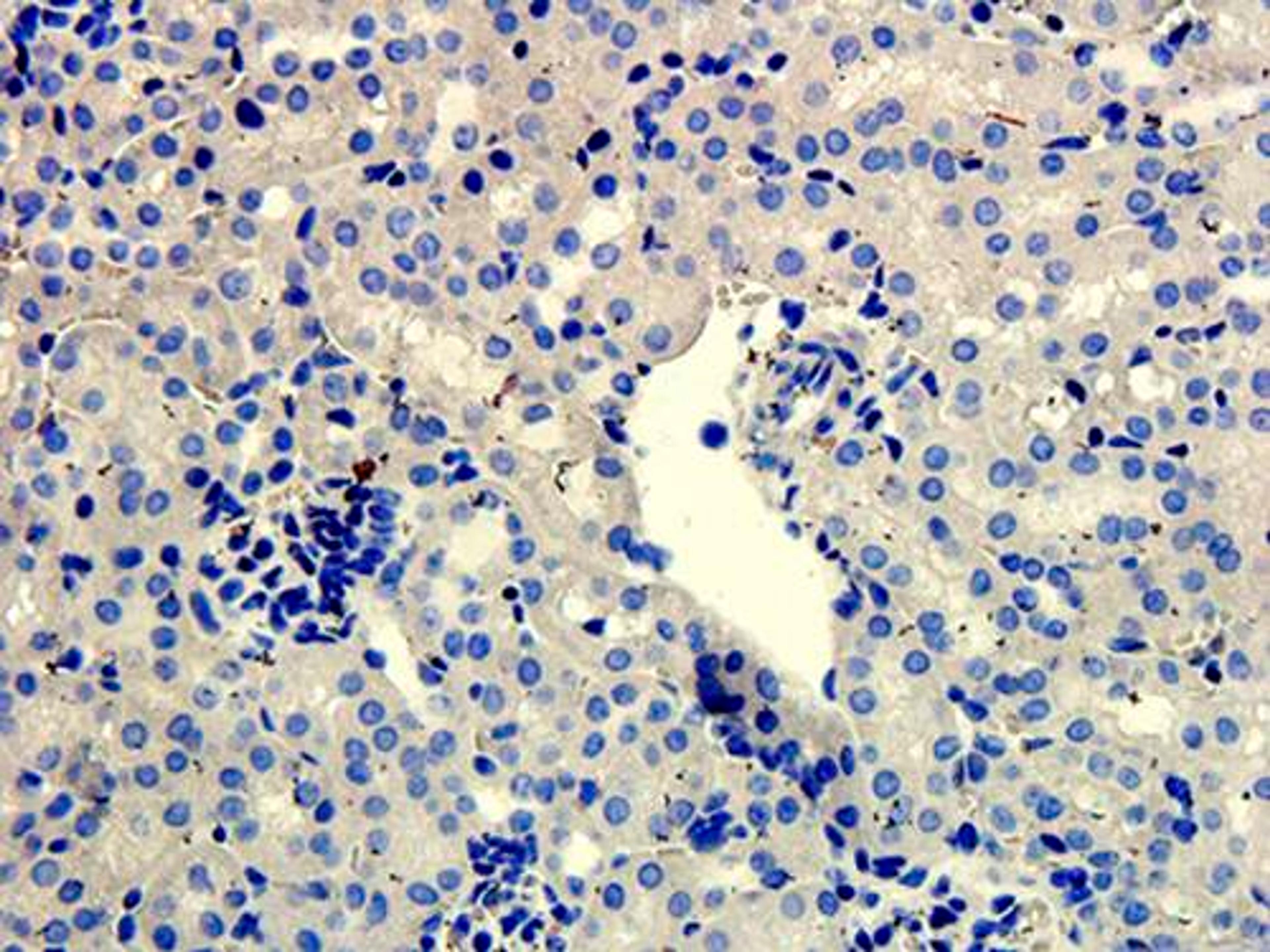 Immunohistochemical staining of paraffin embedded mouse kidney tissue using Snail antibody (primary antibody at 1:200)