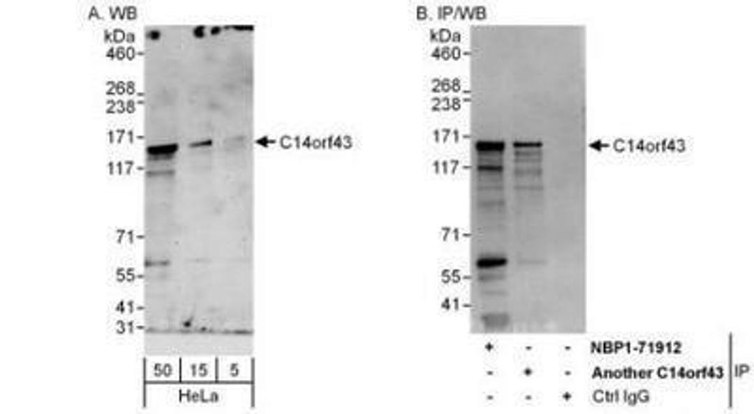 Western Blot: ELMSAN1 Antibody [NBP1-71912] - ELMSAN1 Antibody Whole cell lysate (5, 15 and 50 mcg for WB; 1 mg for IP, 20% of IP loaded) from HeLa cells.   Antibodies: Affinity purified rabbit anti-C14orf43 antibody used for WB at 0.1 mcg/ml (A) and 1 mcg/ml (B) and used for IP at 6 mcg/mg lysate.  C14orf43 was also immunoprecipitated by another rabbit anti-C14orf43 antibody, which recognizes an upstream epitope.