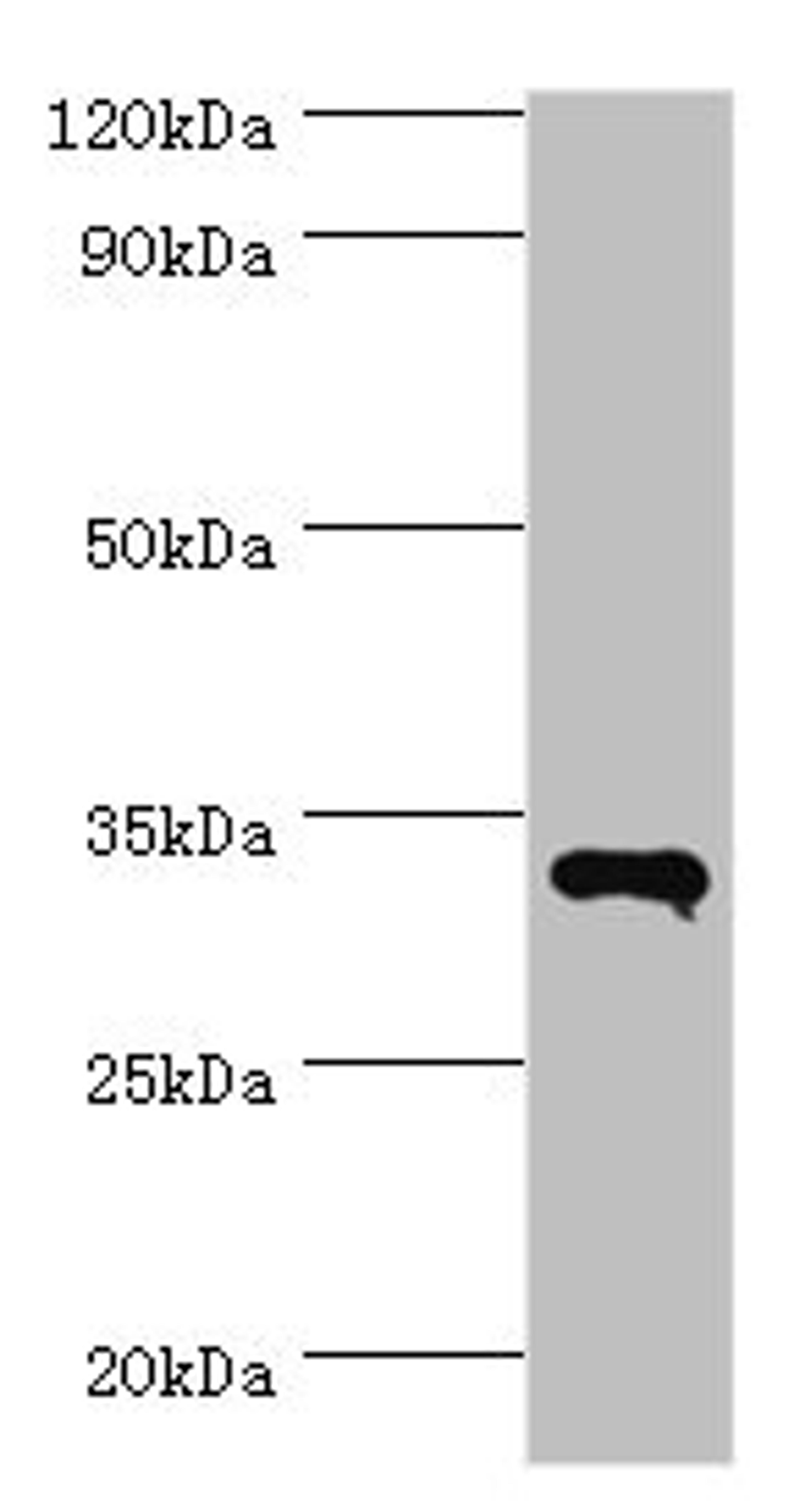 Western blot. All lanes: RNF212 antibody at 14ug/ml + HepG2 whole cell lysate. Secondary. Goat polyclonal to rabbit IgG at 1/10000 dilution. Predicted band size: 34, 15, 22, 32, 27, 31 kDa. Observed band size: 34 kDa.