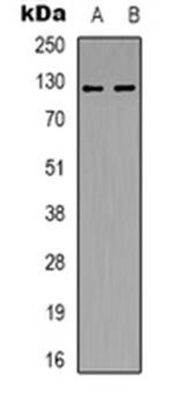 Western blot analysis of POLR3B expression in Hela (Lane 1), HepG2 (Lane 2) whole cell lysates using POLR3B antibody