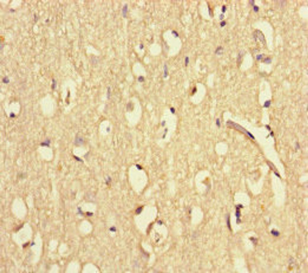 Immunohistochemistry of paraffin-embedded human brain tissue using CSB-PA861133HA01HU at dilution of 1:100