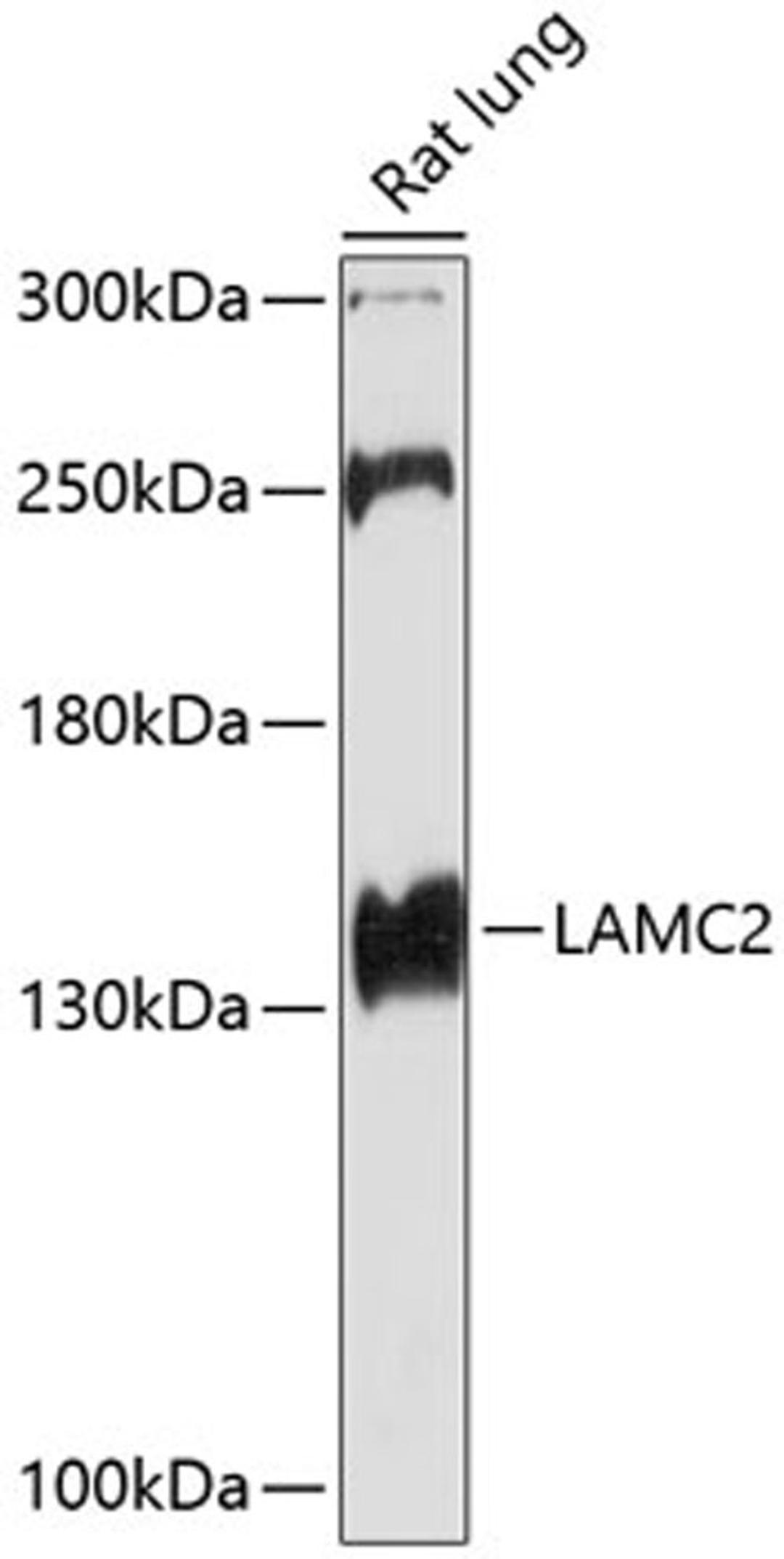 Western blot - LAMC2 antibody (A1869)