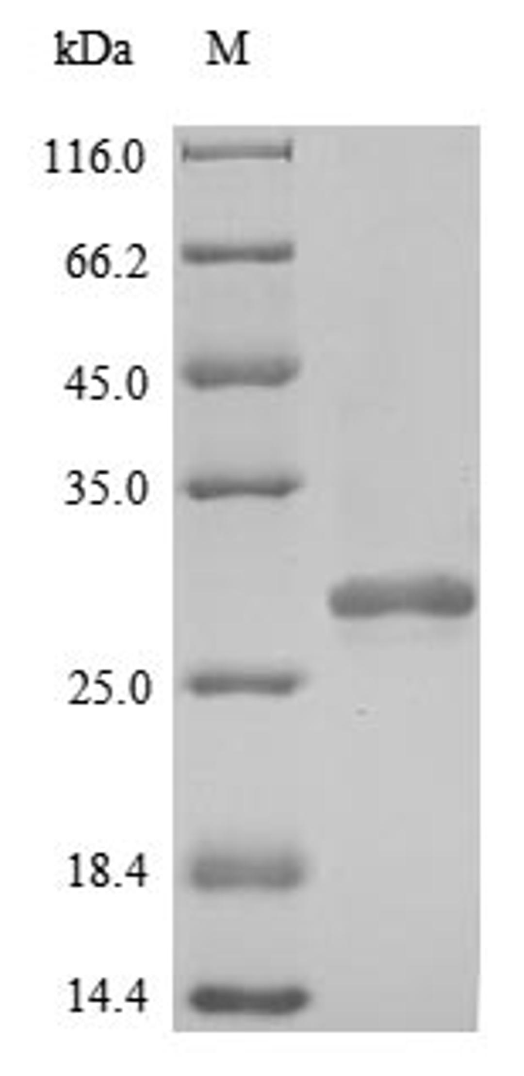 (Tris-Glycine gel) Discontinuous SDS-PAGE (reduced) with 5% enrichment gel and 15% separation gel.