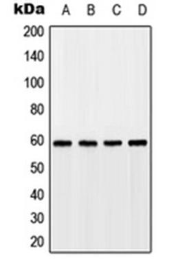 Western blot analysis of HEK293T (Lane 1), A549 (Lane 2), SP2/0 (Lane 3), rat kidney (Lane 4) whole cell lysates using GPR75 antibody