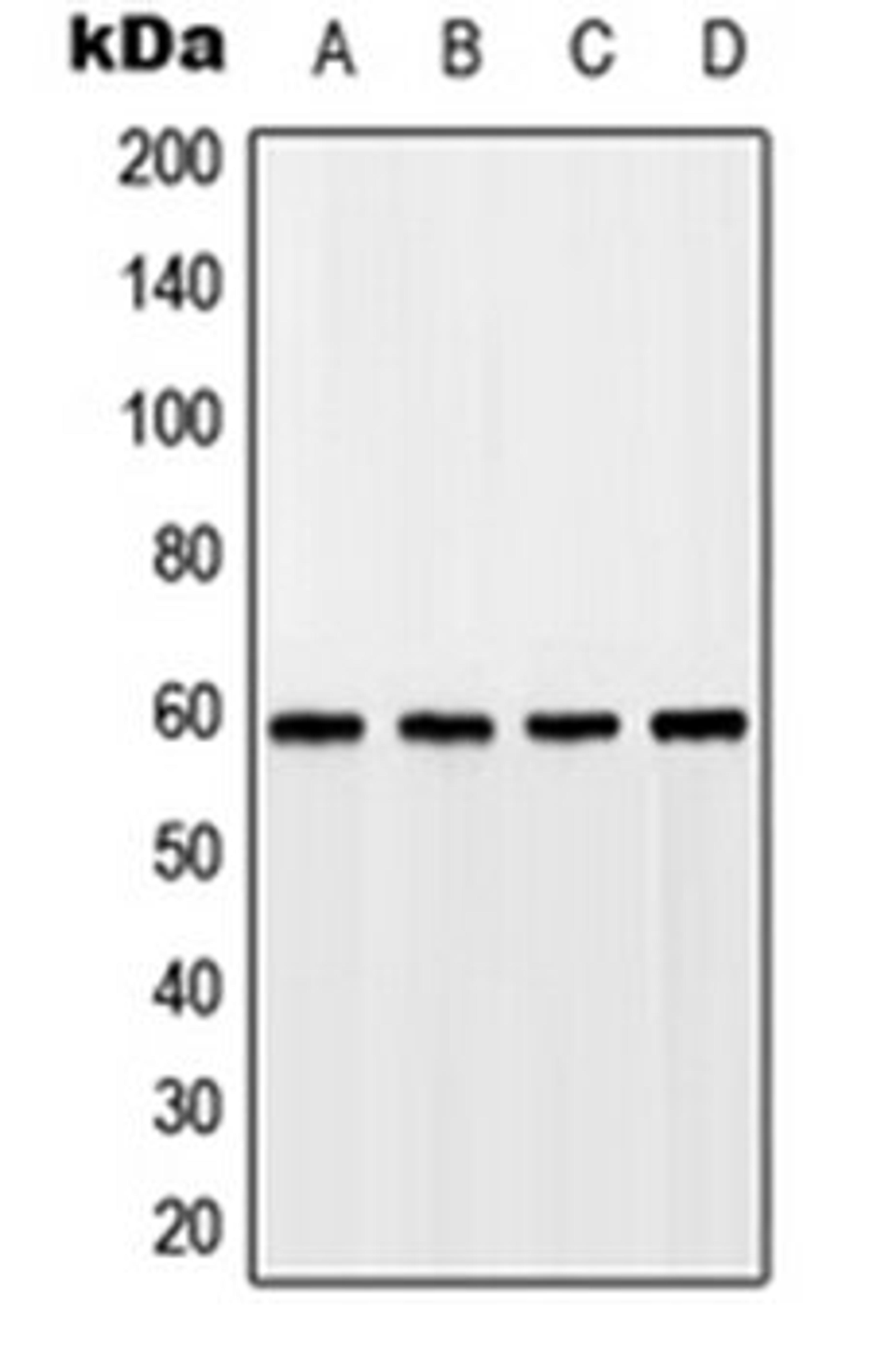 Western blot analysis of HEK293T (Lane 1), A549 (Lane 2), SP2/0 (Lane 3), rat kidney (Lane 4) whole cell lysates using GPR75 antibody