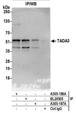 Detection of human TADA3 by western blot of immunoprecipitates.