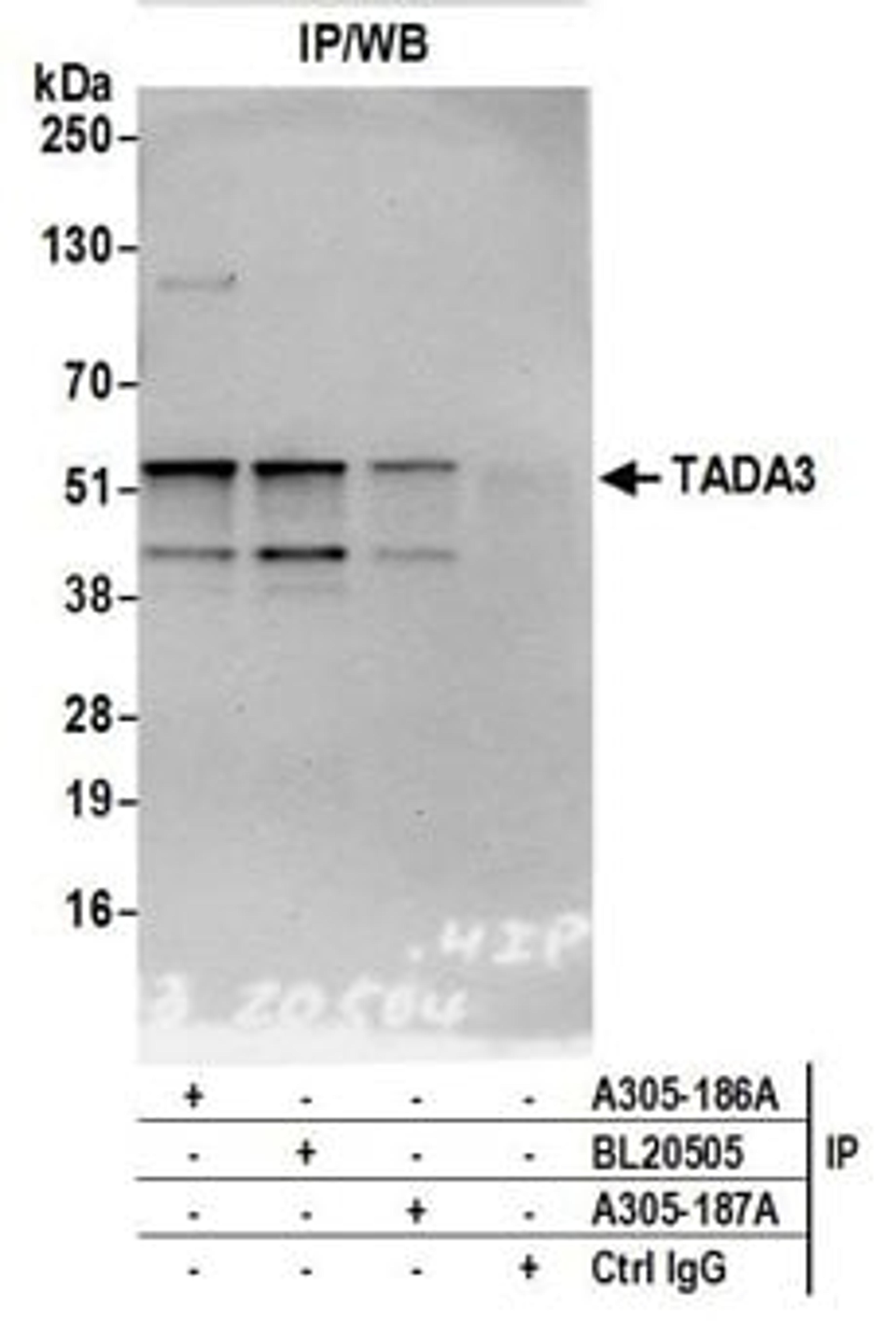 Detection of human TADA3 by western blot of immunoprecipitates.