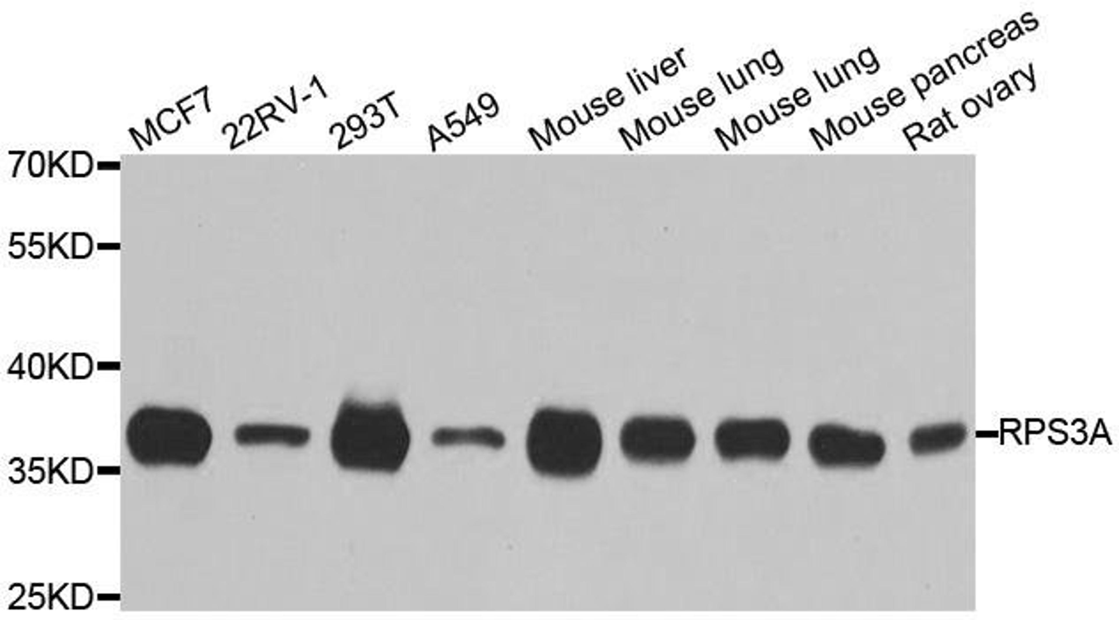 Western blot analysis of extracts of various cell lines using RPS3A antibody