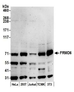 Detection of human and mouse FRMD6 by WB.