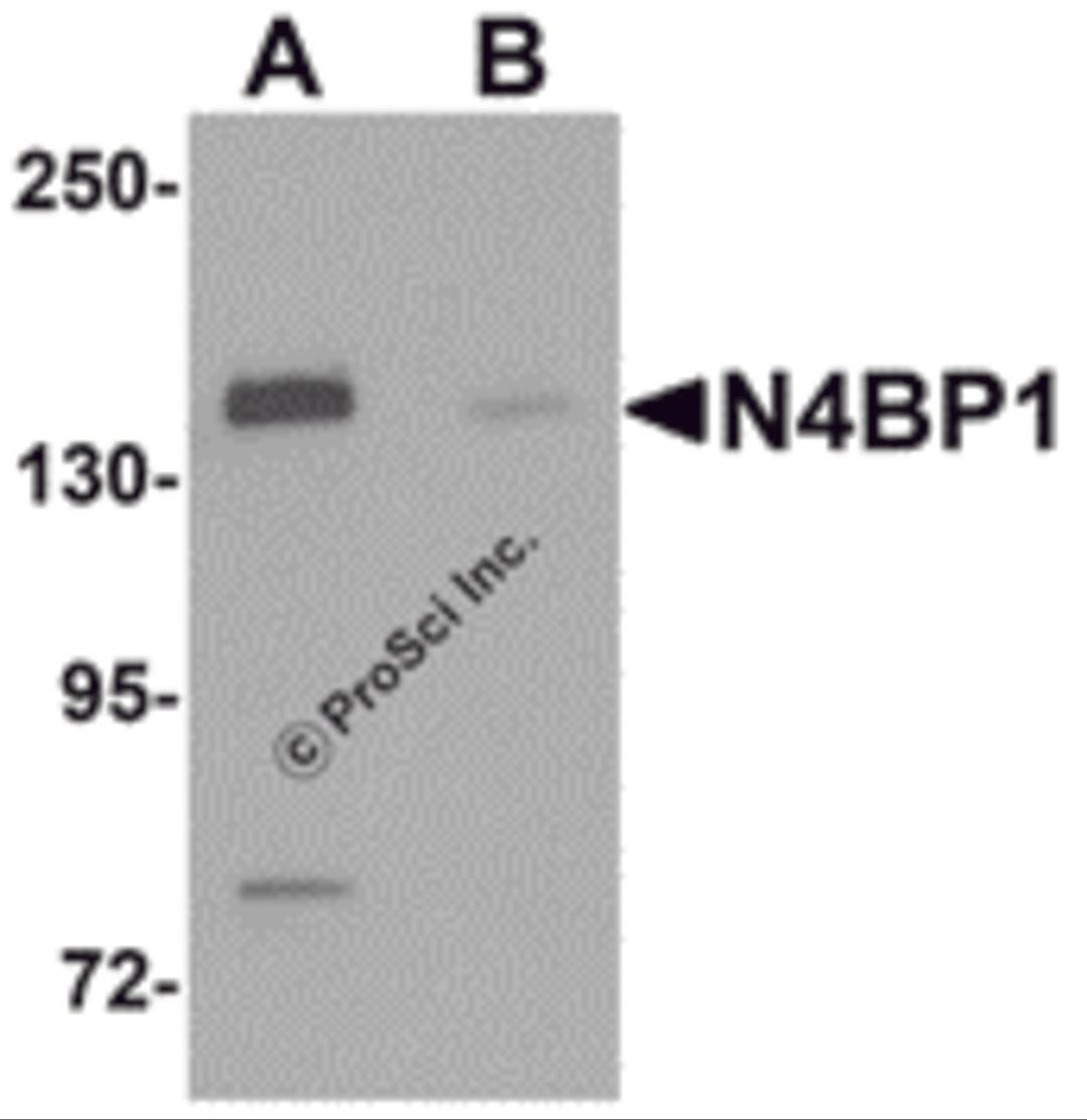 Western blot analysis of N4BP1 in HeLa cell lysate with N4BP1 antibody at 0.5 &#956;g/mL in (A) the absence and (B) the presence of blocking peptide.