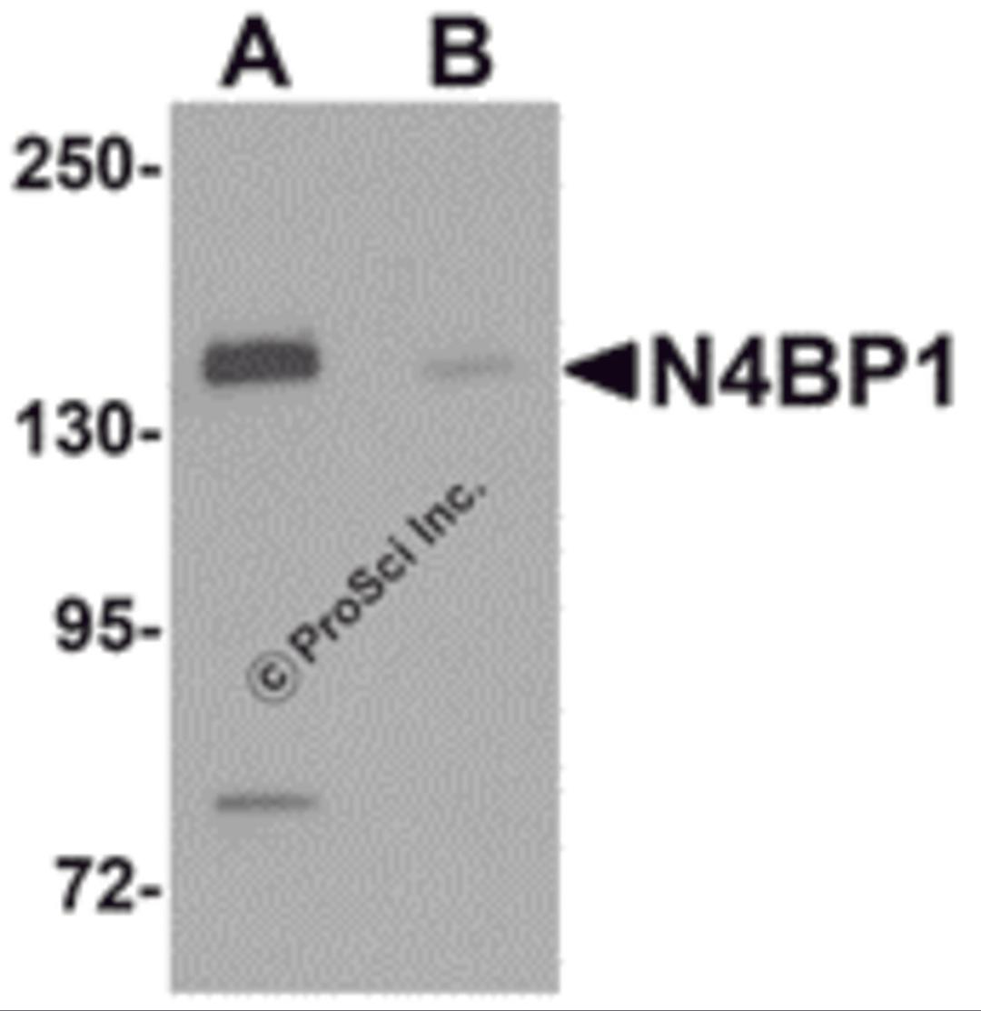 Western blot analysis of N4BP1 in HeLa cell lysate with N4BP1 antibody at 0.5 μg/mL in (A) the absence and (B) the presence of blocking peptide.