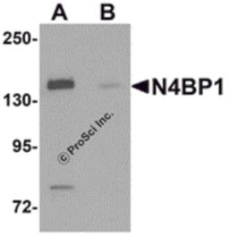 Western blot analysis of N4BP1 in HeLa cell lysate with N4BP1 antibody at 0.5 μg/mL in (A) the absence and (B) the presence of blocking peptide.