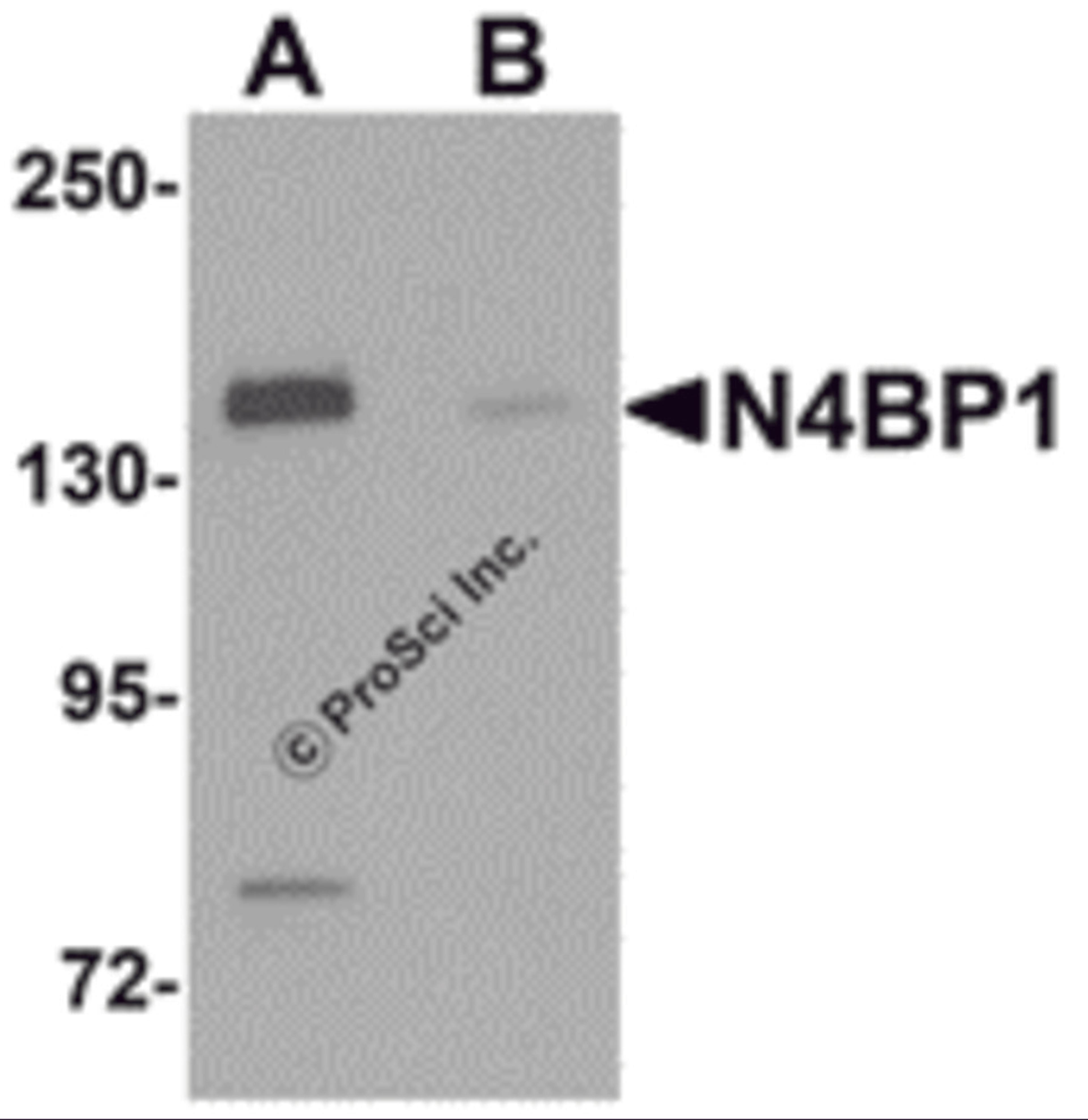 Western blot analysis of N4BP1 in HeLa cell lysate with N4BP1 antibody at 0.5 μg/mL in (A) the absence and (B) the presence of blocking peptide.