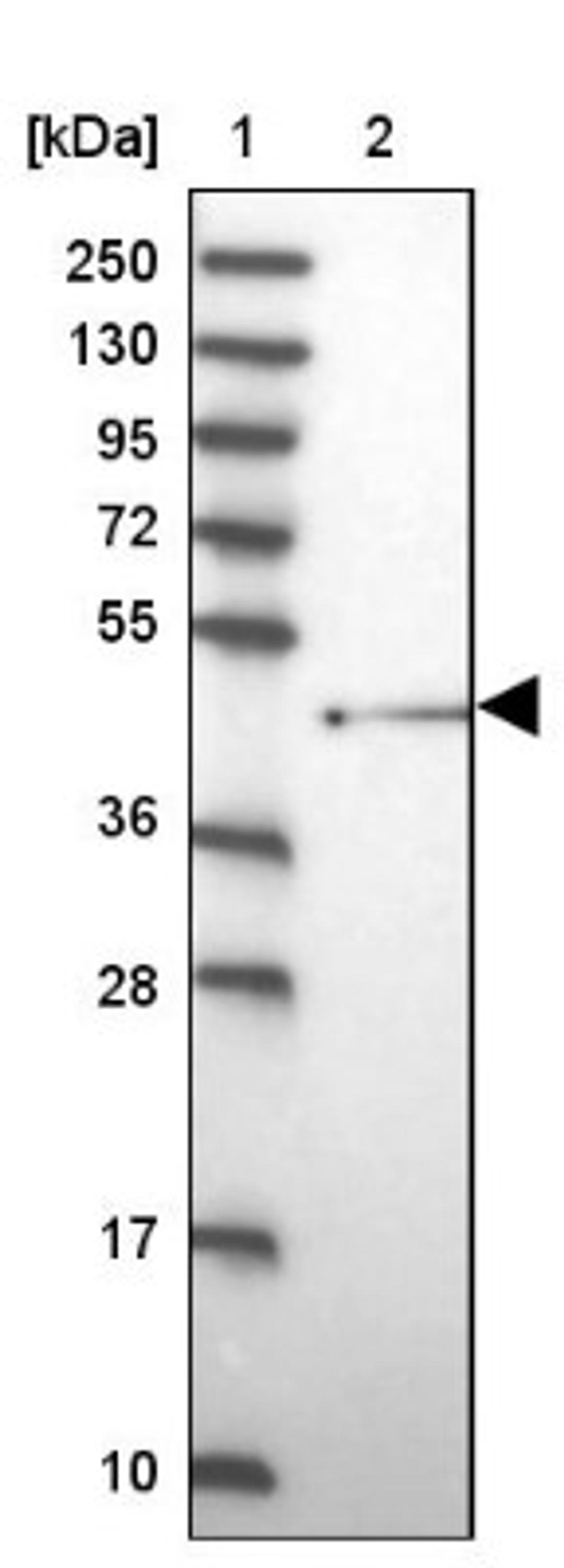 Western Blot: SHFM3 Antibody [NBP2-14013] - Lane 1: Marker [kDa] 250, 130, 95, 72, 55, 36, 28, 17, 10<br/>Lane 2: Human cell line RT-4