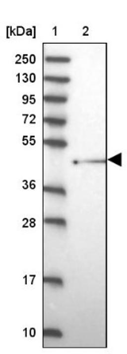 Western Blot: SHFM3 Antibody [NBP2-14013] - Lane 1: Marker [kDa] 250, 130, 95, 72, 55, 36, 28, 17, 10<br/>Lane 2: Human cell line RT-4