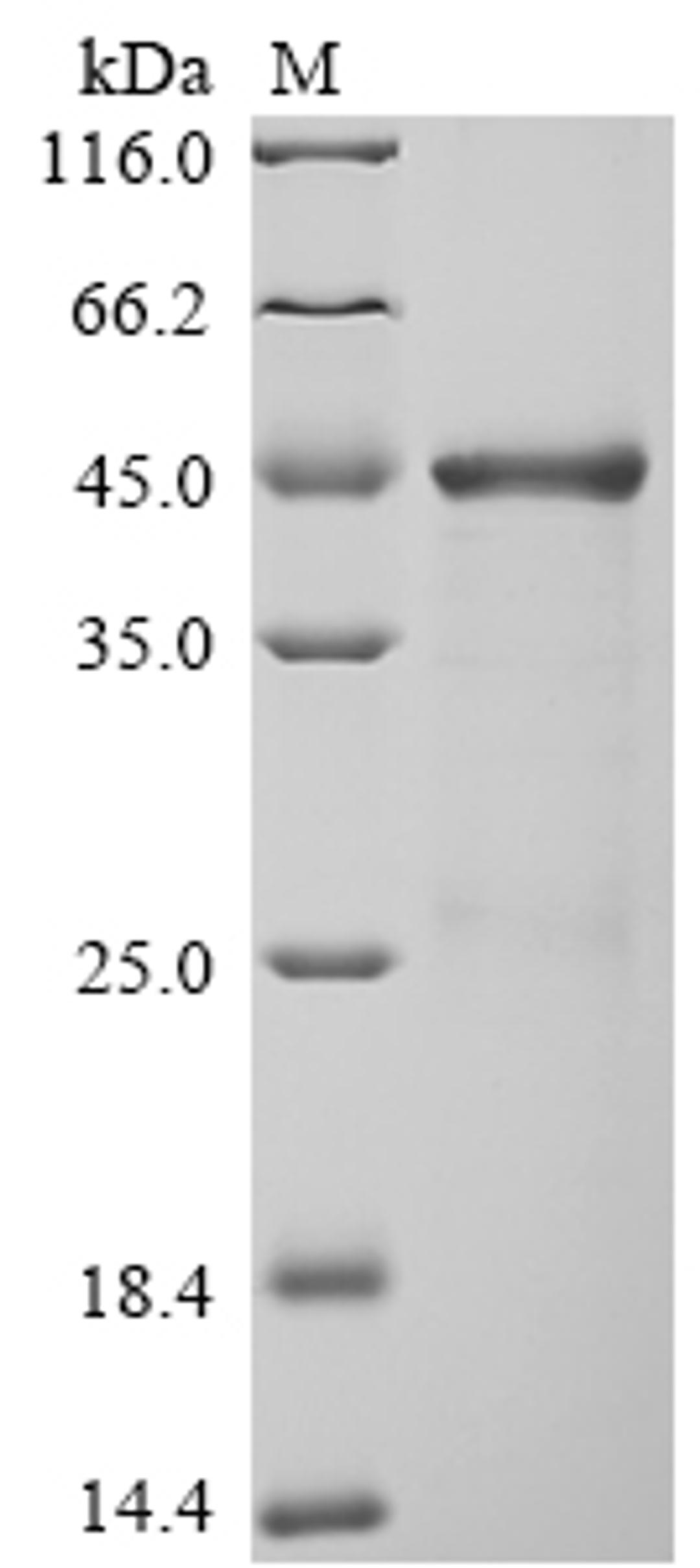 (Tris-Glycine gel) Discontinuous SDS-PAGE (reduced) with 5% enrichment gel and 15% separation gel.