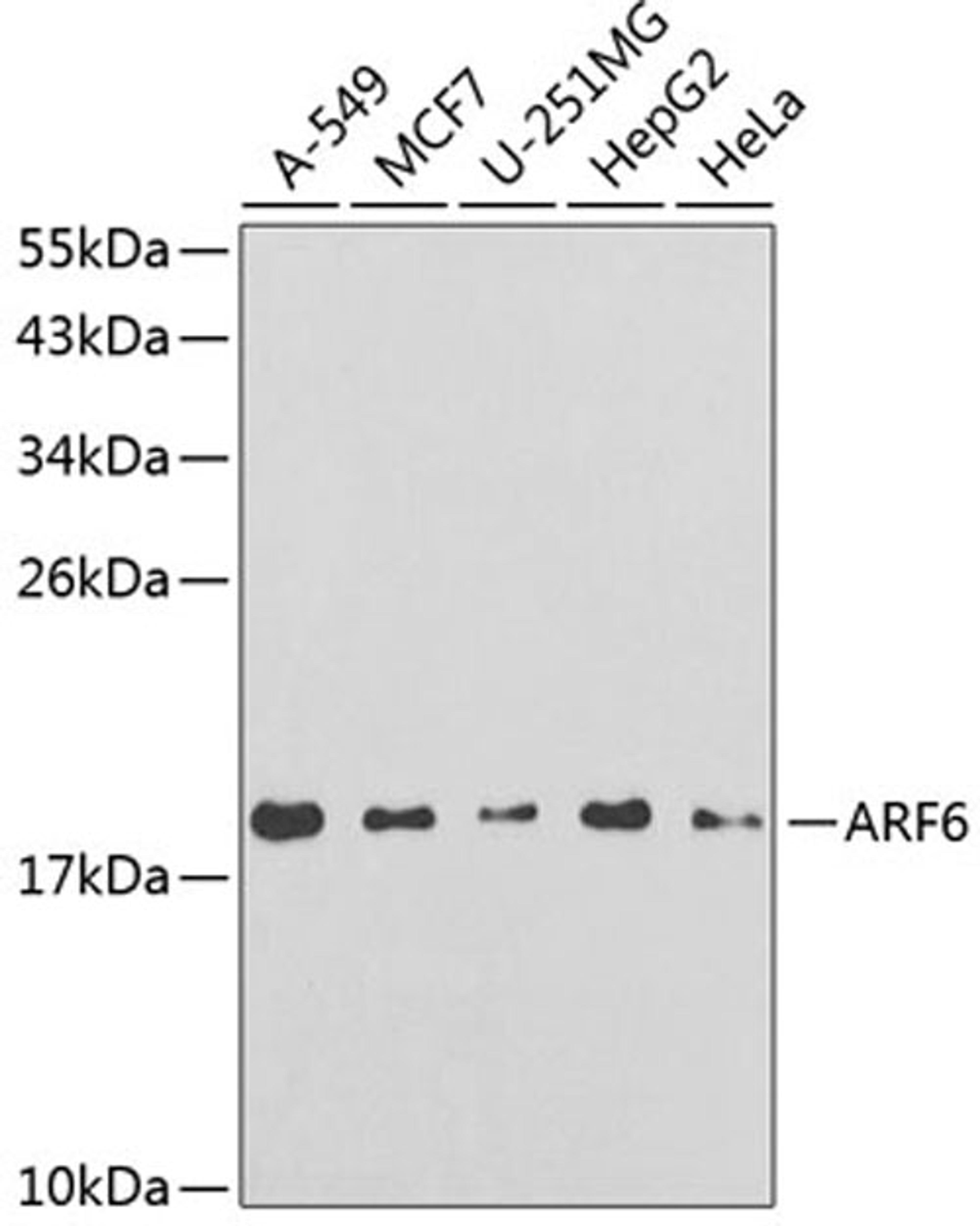 Western blot - ARF6 antibody (A3162)