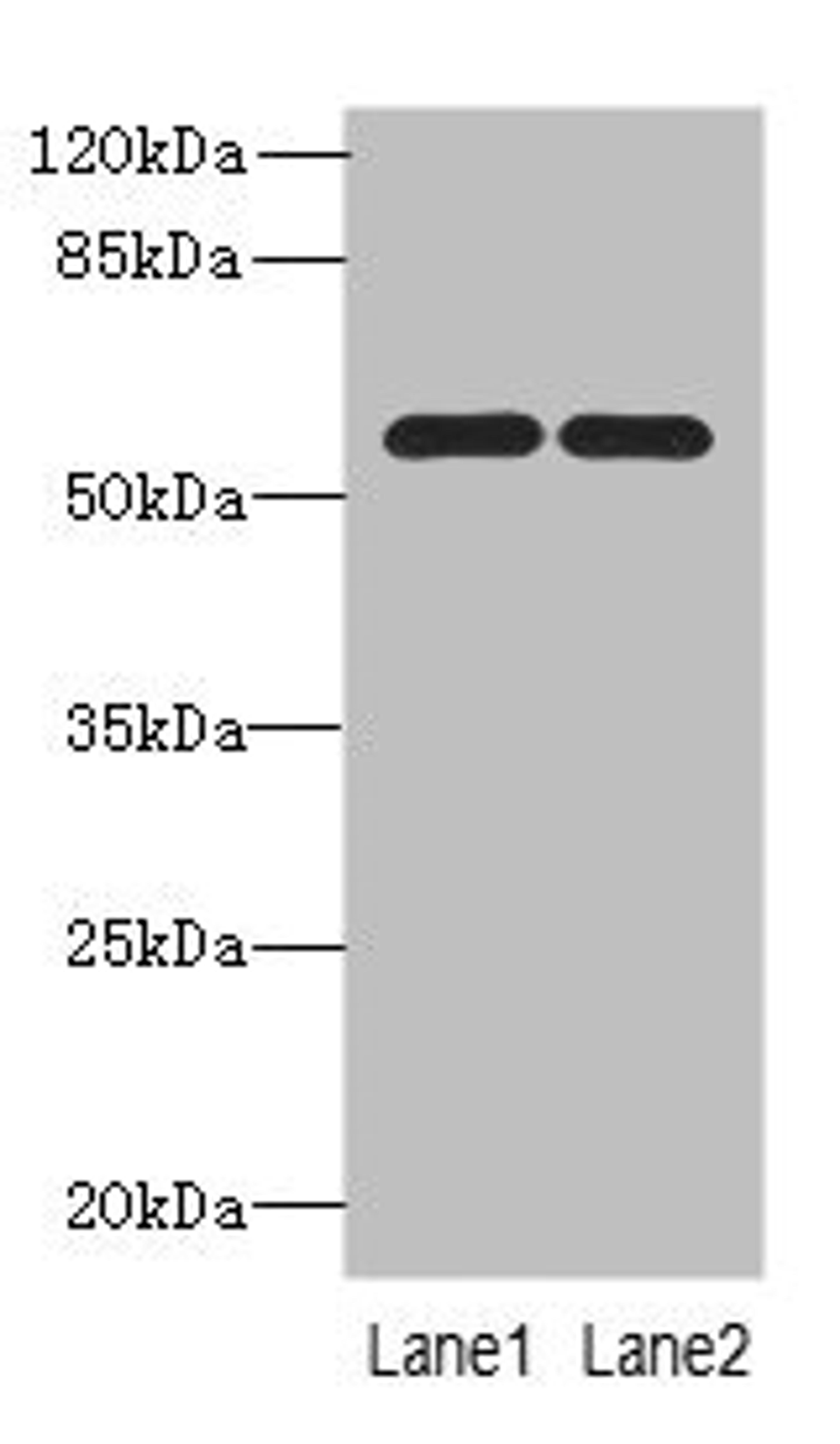 Western blot. All lanes: PSMD12antibody at 0.93ug/ml. Lane 1: U87 whole cell lysate. Lane 2: Hela whole cell lysate. Secondary. Goat polyclonal to rabbit IgG at 1/10000 dilution. Predicted band size: 53, 51 kDa. Observed band size: 53 kDa. 