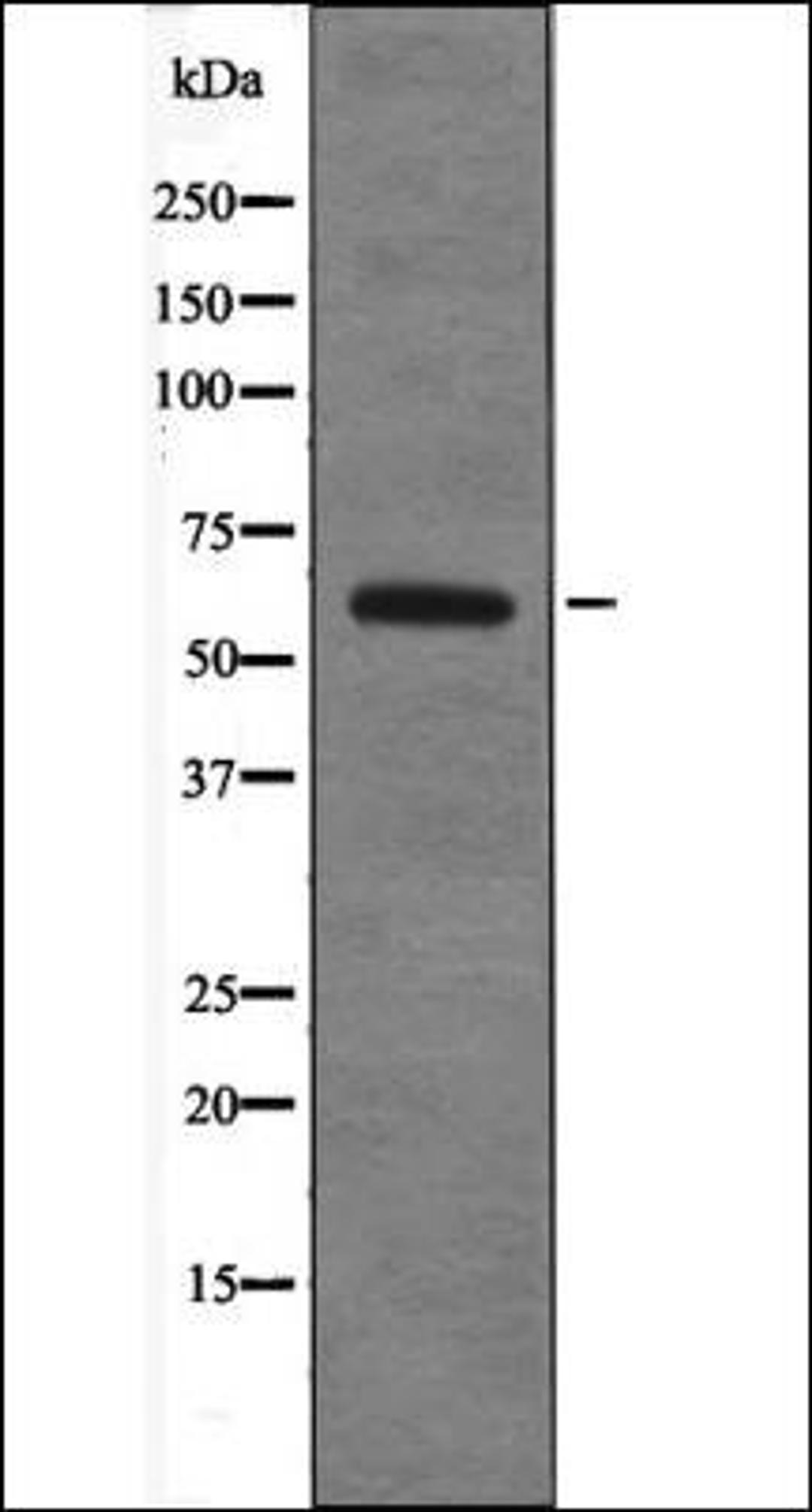 Western blot analysis of 293 whole cell lysates using TRF2 -Phospho-Thr188- antibody