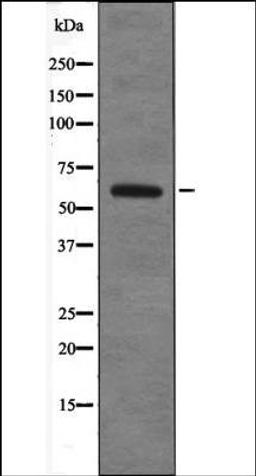 Western blot analysis of 293 whole cell lysates using TRF2 -Phospho-Thr188- antibody