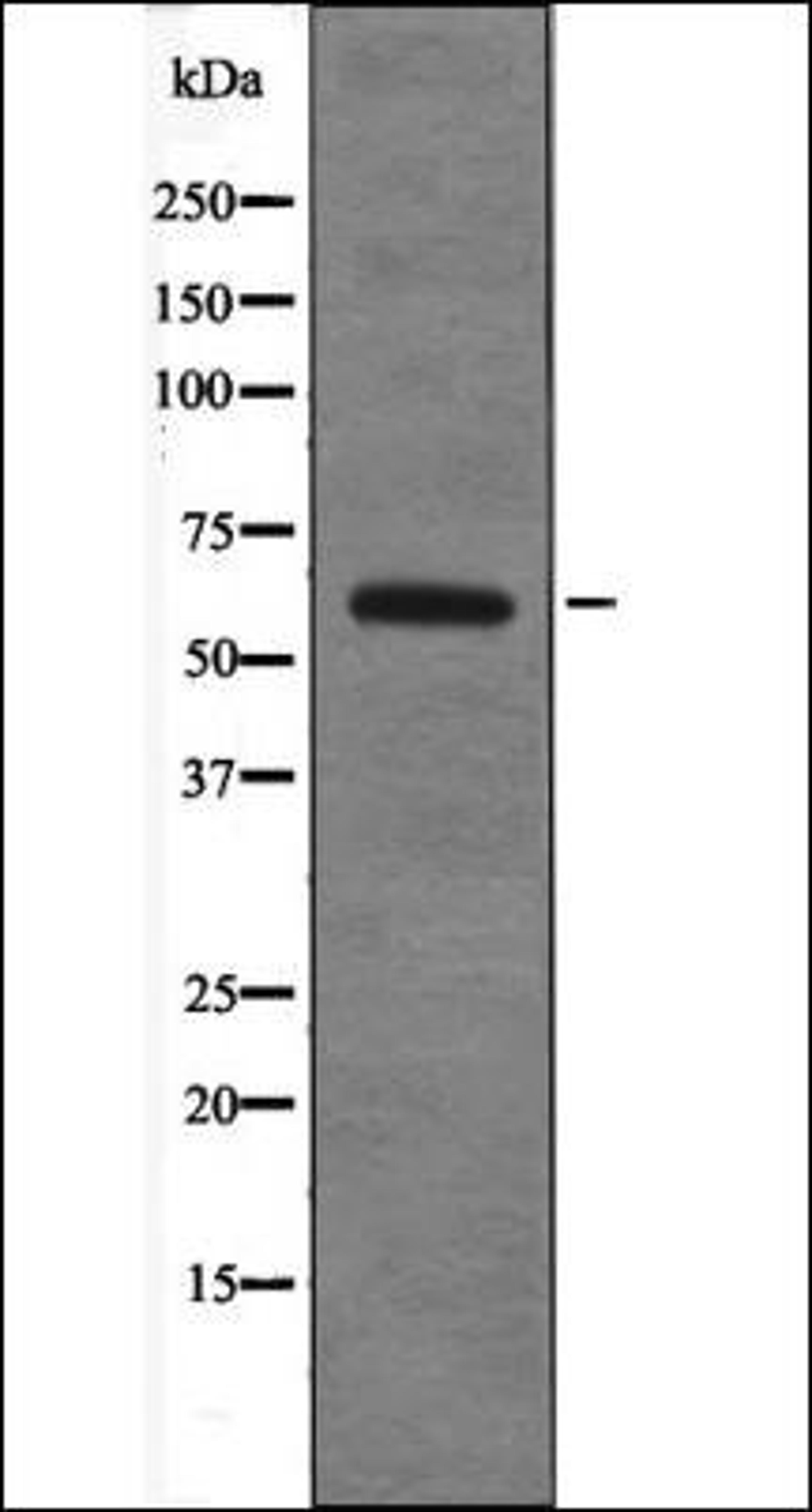 Western blot analysis of 293 whole cell lysates using TRF2 -Phospho-Thr188- antibody