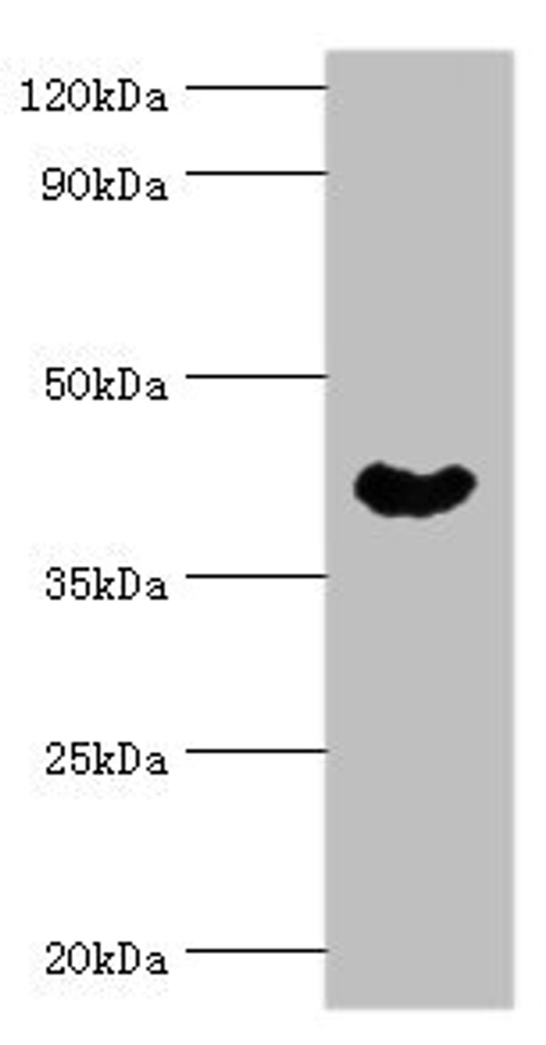 Western blot. All lanes: Cytoplasmic protein NCK1 antibody at 4ug/ml + Rat liver tissue. Secondary. Goat polyclonal to rabbit IgG at 1/10000 dilution. Predicted band size: 43, 36 kDa. Observed band size: 43 kDa. 