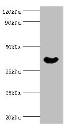 Western blot. All lanes: Cytoplasmic protein NCK1 antibody at 4ug/ml + Rat liver tissue. Secondary. Goat polyclonal to rabbit IgG at 1/10000 dilution. Predicted band size: 43, 36 kDa. Observed band size: 43 kDa. 