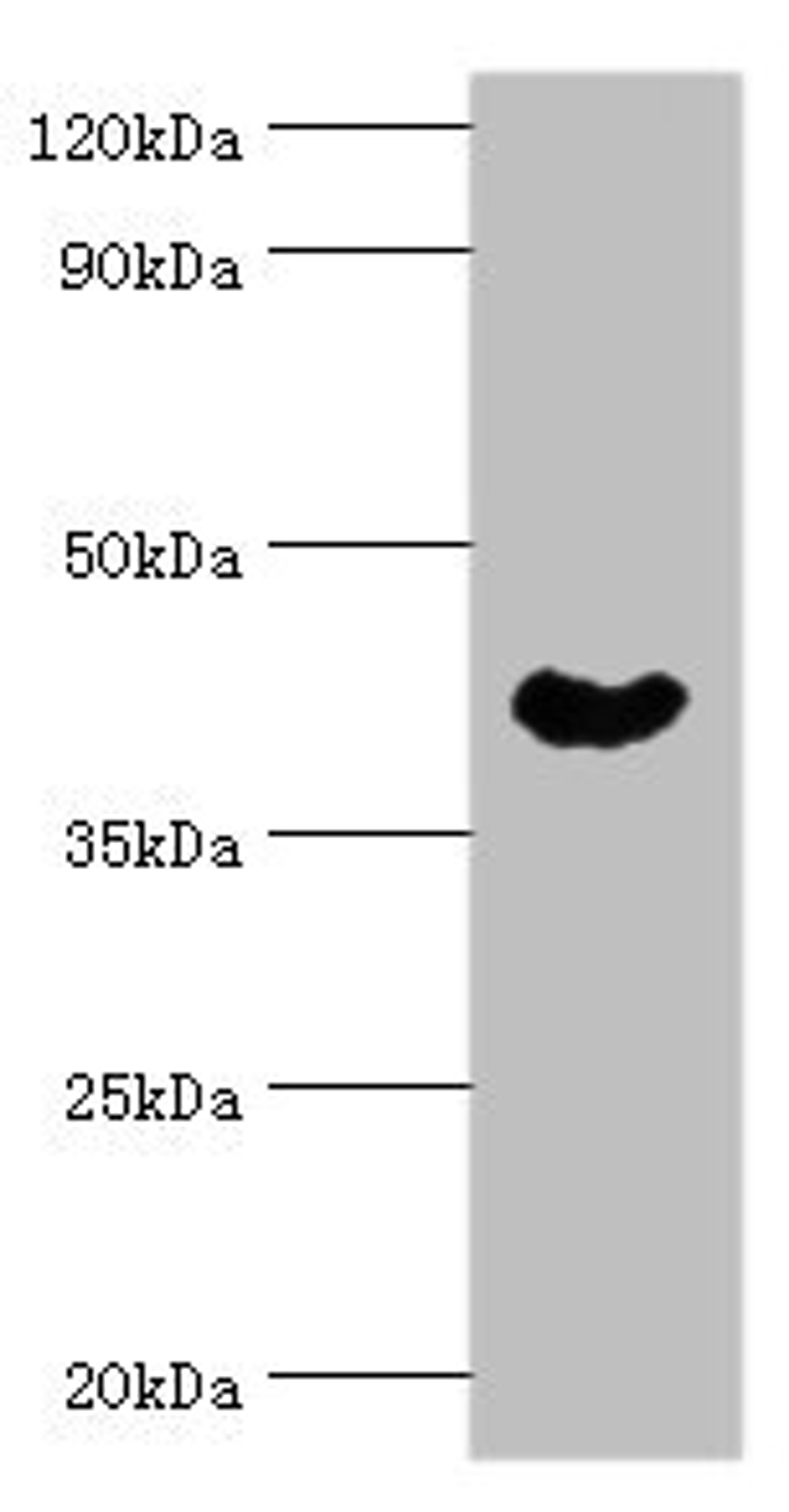 Western blot. All lanes: Cytoplasmic protein NCK1 antibody at 4ug/ml + Rat liver tissue. Secondary. Goat polyclonal to rabbit IgG at 1/10000 dilution. Predicted band size: 43, 36 kDa. Observed band size: 43 kDa. 