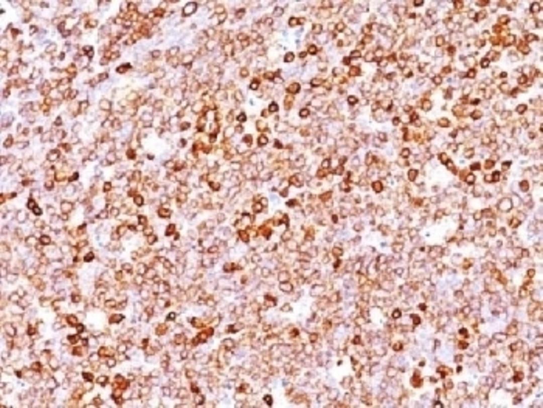 IHC testing of FFPE human tonsil with recombinant CD79a antibody (clone IGA/1688R). Required HIER: boil tissue sections in 10mM citrate buffer, pH 6, for 10-20 min followed by cooling at RT for 20 min.