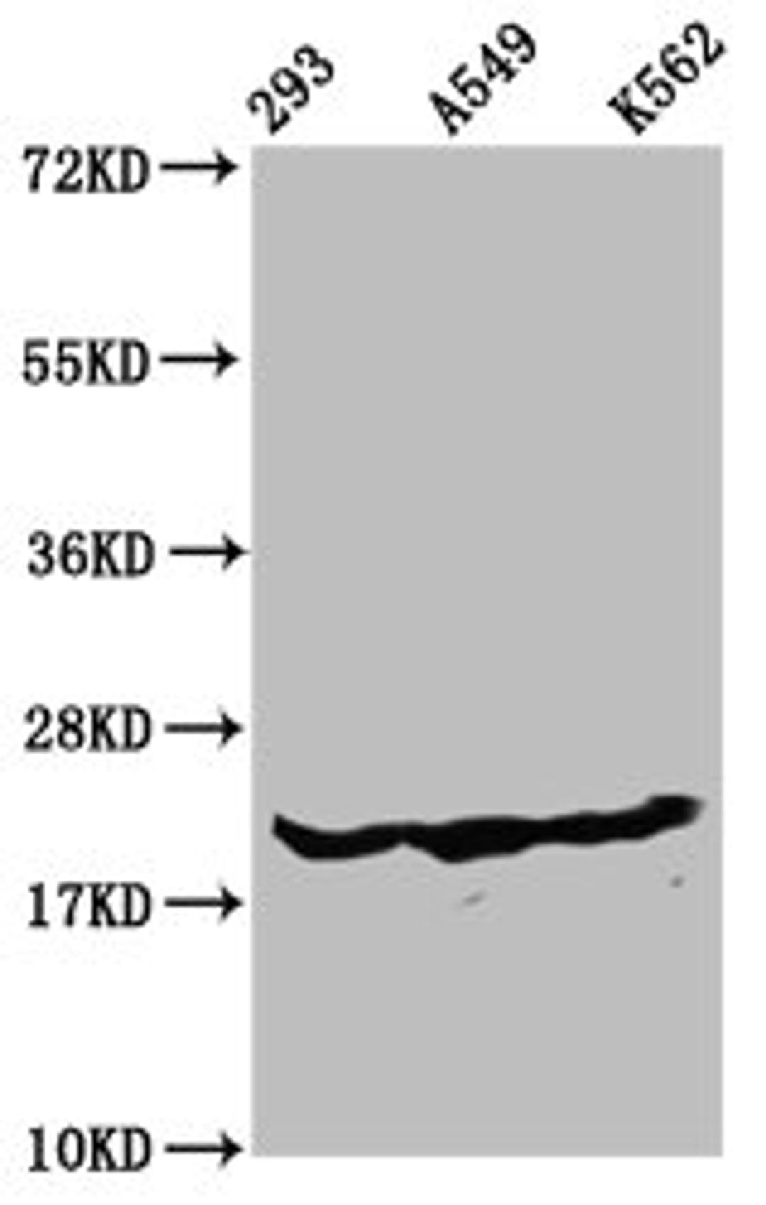 Western Blot. Positive WB detected in: 293 whole cell lysate, A549 whole cell lysate, K562 whole cell lysate (all treated with 30mM sodium butyrate for 4h). All lanes: HIST1H1D antibody at 1.3µg/ml. Secondary. Goat polyclonal to rabbit IgG at 1/50000 dilution. Predicted band size: 23 kDa. Observed band size: 23 kDa