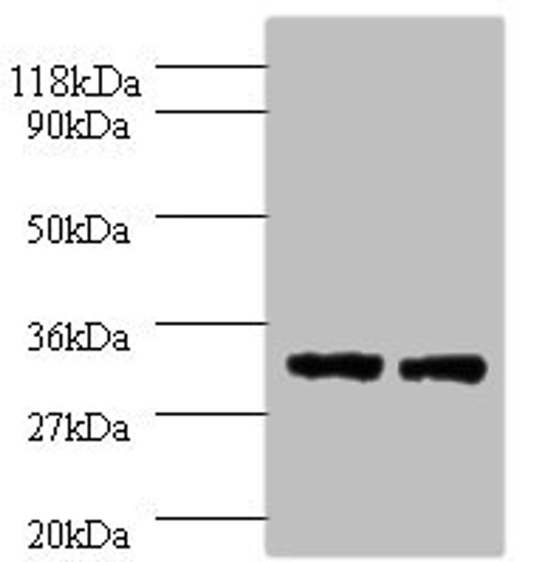 Western blot. All lanes: HLA-DPA1 antibody at 2µg/ml. Lane 1: 293T whole cell lysate. Lane 2: HepG2 whole cell lysate. Secondary. Goat polyclonal to rabbit IgG at 1/10000 dilution. Predicted band size: 30 kDa. Observed band size: 30 kDa