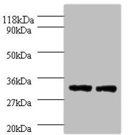 Western blot. All lanes: HLA-DPA1 antibody at 2µg/ml. Lane 1: 293T whole cell lysate. Lane 2: HepG2 whole cell lysate. Secondary. Goat polyclonal to rabbit IgG at 1/10000 dilution. Predicted band size: 30 kDa. Observed band size: 30 kDa