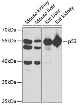 Western blot - p53 antibody (A5804)