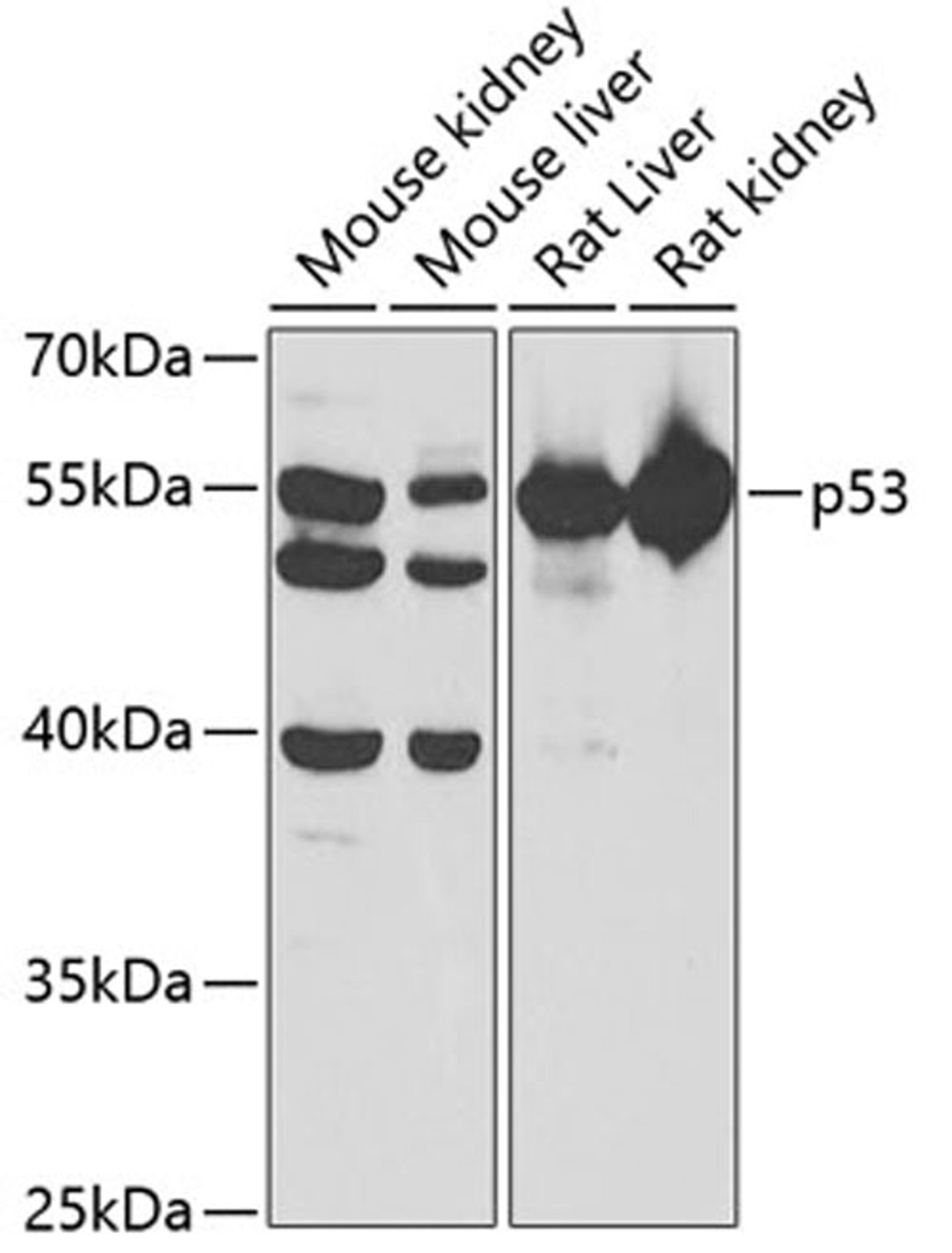 Western blot - p53 antibody (A5804)