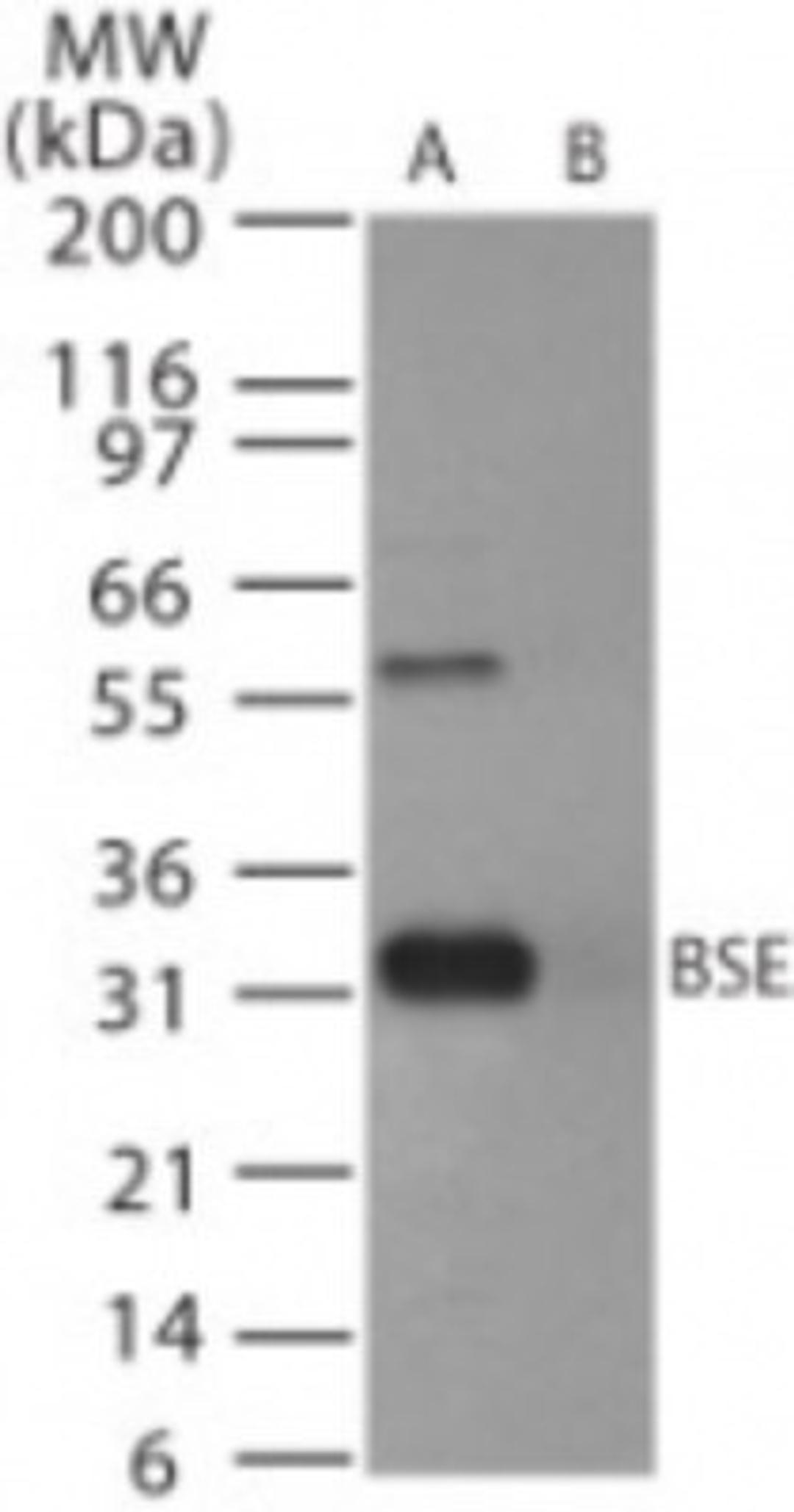 Western Blot: Prion protein Antibody [NB100-56605] - Analysis of BSE in (A) recombinant fusion protein containing amino acids 162-170 and (B) fusion partner without these amino acids, using this antibody at 5 ug/ml.