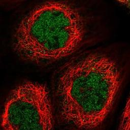 Immunocytochemistry/Immunofluorescence: TTC12 Antibody [NBP1-83693] - Staining of human cell line A-431 shows positivity in nucleus but not nucleoli.