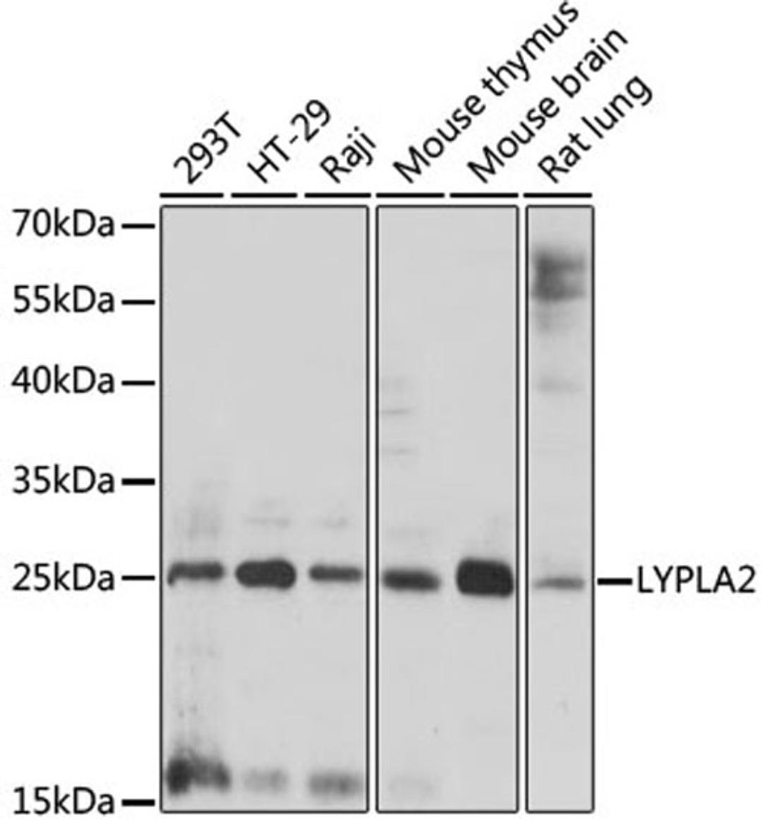 Western blot - LYPLA2 antibody (A15792)