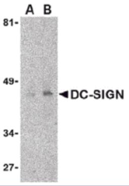 Western blot detection of DC-SIGN in human uterus tissue lysate at (A) 1 and (B) 2 &#956;g/mL.